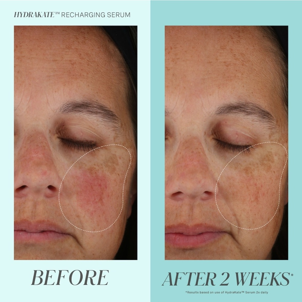 ✨ Kate Somerville HydraKate Recharging Serum | New in box | Full Size ✨MFR 2025 - Picture 6 of 9